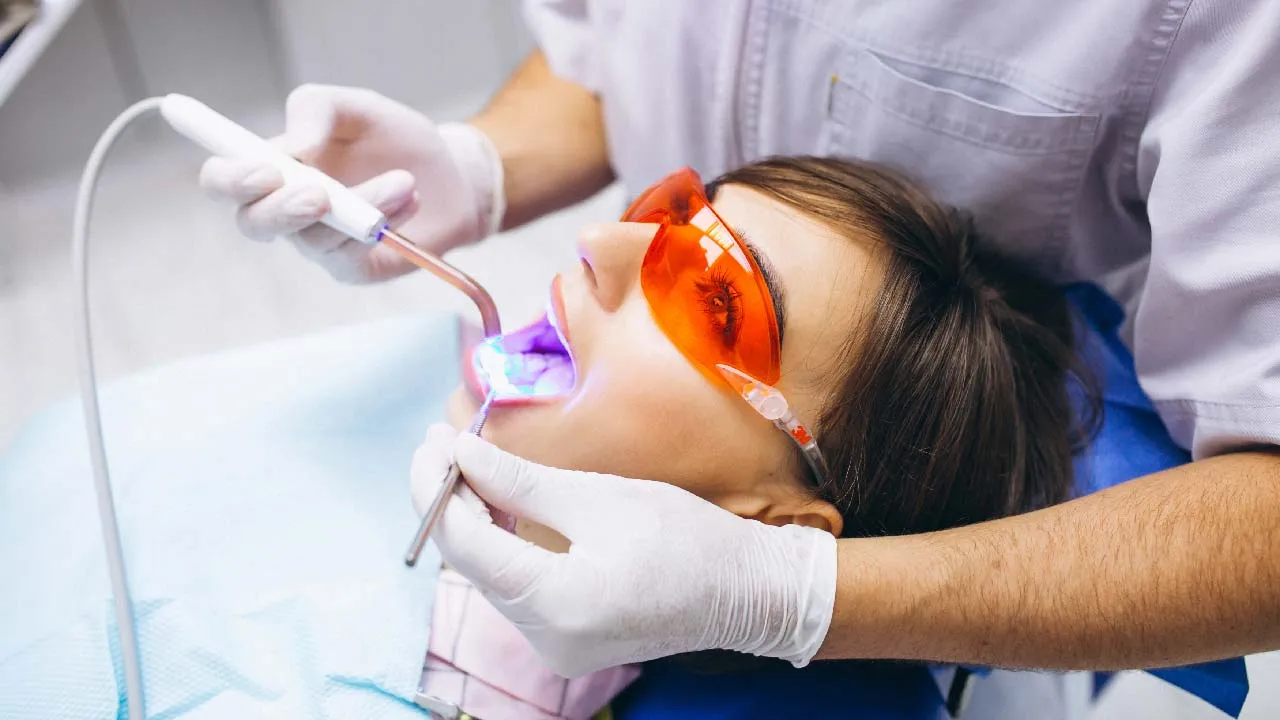 Teeth Whitening Comparison